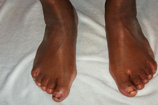 black_feet